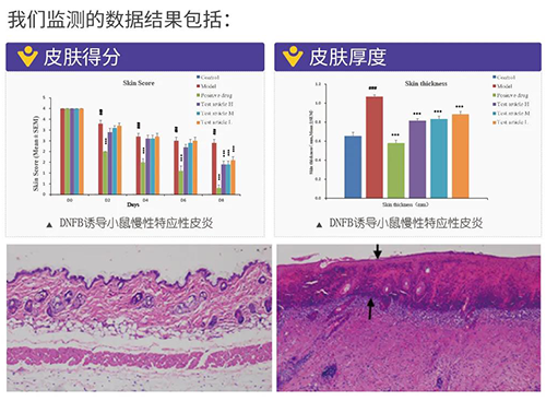 pp电子建立的特应性皮炎及湿疹模型监测数据结果