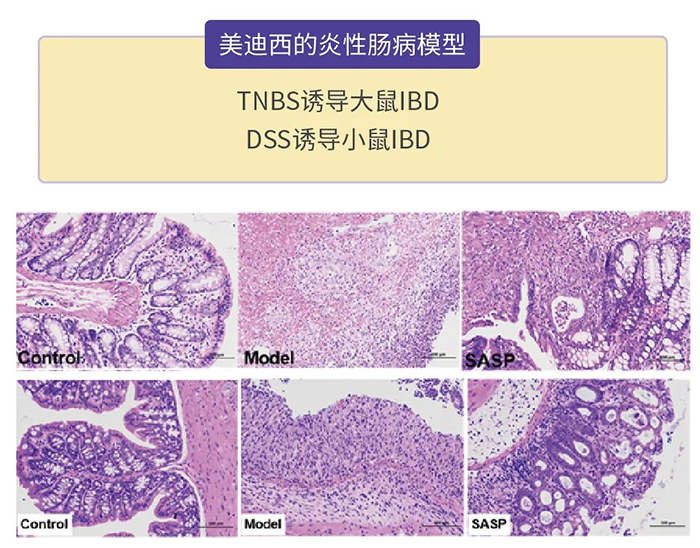 pp电子的炎性肠病模型.png